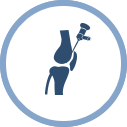About Knee Arthroscopy